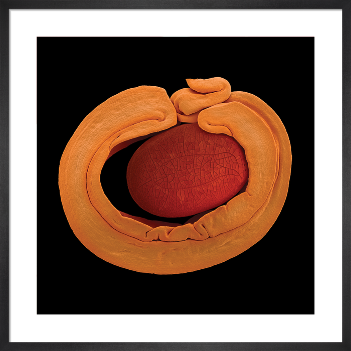 Acacia cyclops (coastal wattle)