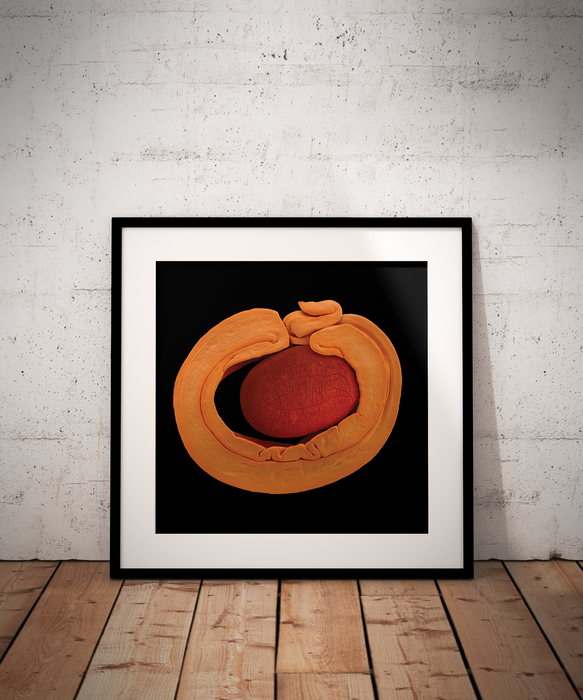 Acacia cyclops (coastal wattle)