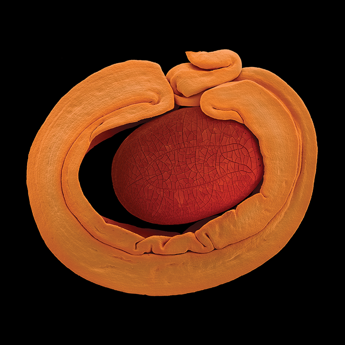 Acacia cyclops (coastal wattle)