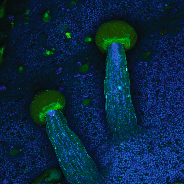 Cannabis sativa (marijuana)