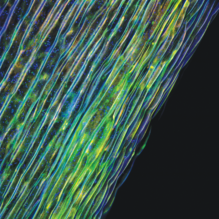 Tabernaemontana undulata (becchete)