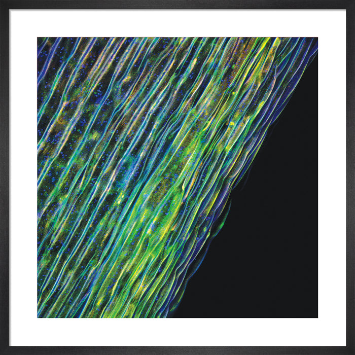 Tabernaemontana undulata (becchete)